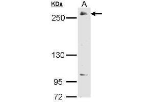 WB Image Sample (30 ug of whole cell lysate) A: 293T 5% SDS PAGE antibody diluted at 1:2000 (POLR2A/RPB1 anticorps  (C-Term))