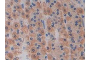 Detection of LMP7 in Rat Stomach Tissue using Polyclonal Antibody to Large Multifunctional Peptidase 7 (LMP7)