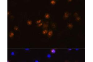 Immunofluorescence analysis of L929 cells using SWAP70 Polyclonal Antibody at dilution of 1:100. (SWAP70 anticorps)
