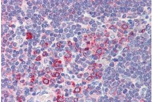 Human Thymus (formalin-fixed, paraffin-embedded) stained with BCL11A antibody ABIN462216 followed by biotinylated goat anti-rabbit IgG secondary antibody ABIN481713, alkaline phosphatase-streptavidin and chromogen.