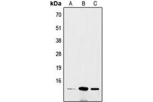 Western blot analysis of BRI3 expression in Hela (A), mouse brain (B), rat colon (C) whole cell lysates. (BRI3 anticorps  (N-Term))
