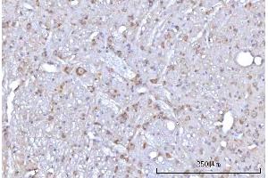 IHC analysis of RAP1GAP using anti-RAP1GAP antibody (ABIN7599729). (RAP1GAP anticorps  (AA 11-661))