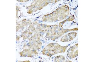 Immunohistochemistry of paraffin-embedded human stomach using CDKN2C antibody at dilution of 1:100 (40x lens).