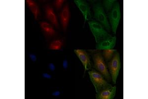 ABIN6265844 and ABIN6276978 staining  cells by IF/ICC. (UBE2D1 anticorps  (C-Term))
