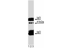 Western blot analysis of Doublecortin on a mouse neonate lysate. (Doublecortin anticorps  (AA 211-317))