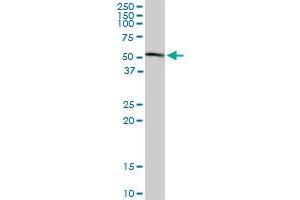 HDAC3 monoclonal antibody (M02), clone 3E11. (HDAC3 anticorps  (AA 319-428))