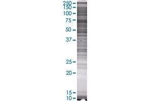 SYK transfected lysate. (SYK 293T Cell Transient Overexpression Lysate(Denatured))