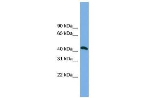 ANKMY2 antibody used at 1 ug/ml to detect target protein. (ANKMY2 anticorps  (N-Term))