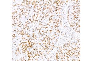 anti-Serum Response Factor (SRF) (AA 25-75) antibody