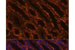 Immunofluorescence analysis of Rat kidney using LAMC2 Polyclonal Antibody at dilution of 1:100 (40x lens).