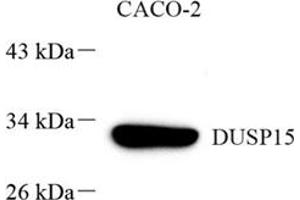 Western blot analysis of DUSP15 (ABIN7073774) at dilution of 1: 1000 (DUSP15 anticorps)