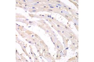 Immunohistochemistry of paraffin-embedded mouse heart using PSMB1 antibody.