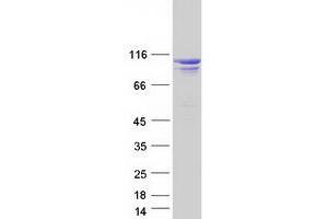 Validation with Western Blot (OCRL Protein (Transcript Variant B) (Myc-DYKDDDDK Tag))