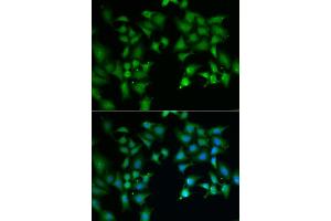 Immunofluorescence analysis of A549 cells using FLOT2 antibody (ABIN5973960). (Flotillin 2 anticorps)