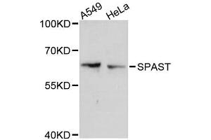Western blot analysis of extracts of various cell lines, using SPAST antibody (ABIN5996162) at 1:3000 dilution. (Spastin anticorps)
