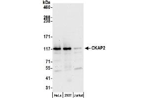 anti-Cytoskeleton Associated Protein 2 (CKAP2) (AA 633-683) antibody
