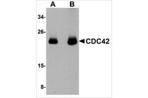 Western blot analysis of CDC42 in human brain tissue lysate with CDC42 antibody at (A) 0. (CDC42 anticorps  (N-Term))