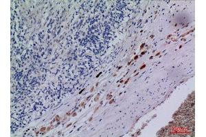 Immunohistochemistry (IHC) analysis of paraffin-embedded Human Brain, antibody was diluted at 1:100.