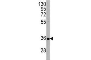APG5 antibody western blot analysis in HeLa lysate. (ATG5 anticorps  (AA 1-30))