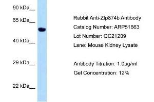 WB Suggested Anti-Zfp874b Antibody   Titration: 1. (Chitinase anticorps  (Middle Region))