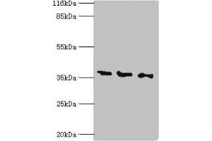 Western blot All lanes: N-acetyl-D-glucosamine kinase antibody at 2 μg/mL Lane 1: HepG2 whole cell lysate Lane 2: 293T whole cell lysate Lane 3: Hela whole cell lysate Secondary Goat polyclonal to rabbit IgG at 1/10000 dilution Predicted band size: 38, 43 kDa Observed band size: 38 kDa (NAGK anticorps  (AA 2-344))