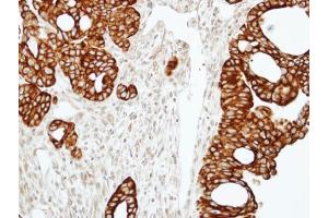 IHC-P Image Immunohistochemical analysis of paraffin-embedded N87 xenograft, using RAP2C, antibody at 1:100 dilution.