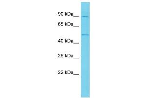 Host: Rabbit Target Name: ANKRD10 Sample Type: U937 Whole Cell lysates Antibody Dilution: 1. (ANKRD10 anticorps  (C-Term))