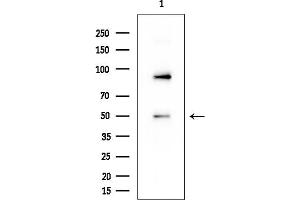 anti-Forkhead Box O4 (FOXO4) (Internal Region) antibody