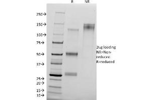 SDS-PAGE Analysis of Purified CTNND1 Mouse Monoclonal Antibody (25a). (CTNND1 anticorps)