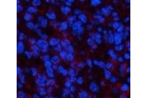 Immunofluorescence analysis of Mouse spleen tissue using PPARD Monoclonal Antibody at dilution of 1:200. (PPARD anticorps)
