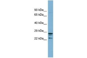 WB Suggested Anti-CUTC  Antibody Titration: 0.