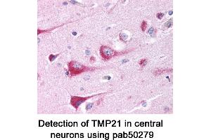 Image no. 1 for anti-Transmembrane Emp24-Like Trafficking Protein 10 (TMED10) (AA 100-200) antibody (ABIN363588)