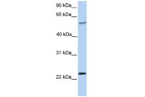 Synaptogyrin 2 antibody used at 1 ug/ml to detect target protein. (SYNGR2 anticorps  (N-Term))