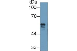 Detection of FGB in Bovine Serum using Polyclonal Antibody to Fibrinogen Beta Chain (FGB) (Fibrinogen beta Chain anticorps  (AA 49-495))