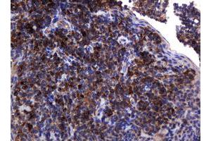 Image no. 11 for anti-Pogo Transposable Element with KRAB Domain (POGK) antibody (ABIN1500329)