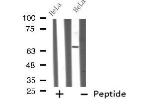 Western blot analysis GRK4 using HeLa whole cell lysates (GRK4 anticorps  (N-Term))