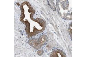 Immunohistochemical staining of human prostate with B4GALNT2 polyclonal antibody  shows strong cytoplasmic positivity in glandular cells. (B4GALNT2 anticorps)