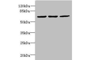 Western blot All lanes: INTS11 antibody at 2 μg/mL Lane 1: Colo320 whole cell lysate Lane 2: Hela whole cell lysate Lane 3: MCF-7 whole cell lysate Secondary Goat polyclonal to Rabbit IgG at 1/10000 dilution Predicted band size: 68, 57, 66, 65, 69 kDa Observed band size: 68 kDa (CPSF3L anticorps  (AA 331-600))