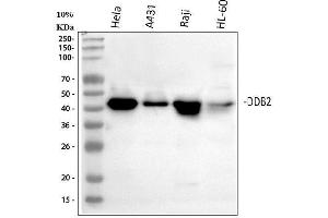 Western blot analysis of DDB2 using anti-DDB2 antibody (ABIN7599601).
