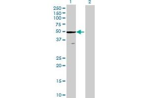 Western Blot analysis of ZCCHC3 expression in transfected 293T cell line by ZCCHC3 MaxPab polyclonal antibody. (ZCCHC3 anticorps  (AA 1-403))