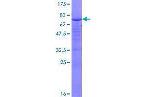 Image no. 1 for Zinc Finger, CCHC Domain Containing 11 (ZCCHC11) (AA 1-309) protein (GST tag) (ABIN1325656)