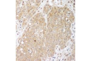 anti-Cbl Proto-Oncogene B, E3 Ubiquitin Protein Ligase (CBLB) (AA 450-500) antibody