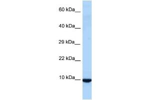 WB Suggested Anti-Id3 Antibody Titration: 1. (ID3 anticorps  (Middle Region))