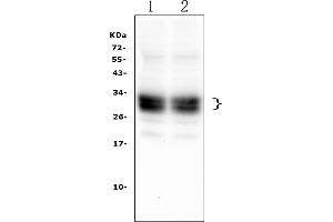 Western blot analysis of CD8A using anti-CD8A antibody (ABIN6719524).