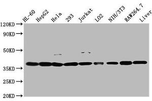 Western Blot Positive WB detected in: HL60 whole cell lysate, HepG2 whole cell lysate, Hela whole cell lysate, 293 whole cell lysate, Jurkat whole cell lysate, LO2 whole cell lysate, NIH/3T3 whole cell lysate, RAW264. (MDH1 anticorps  (AA 1-334))