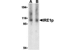 Western Blotting (WB) image for anti-Endoplasmic Reticulum To Nucleus Signaling 1 (ERN1) (Middle Region) antibody (ABIN1030962) (ERN1 anticorps  (Middle Region))