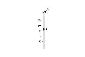 Anti-G Antibody (Center) at 1:2000 dilution + Rat brain whole tissue lysate Lysates/proteins at 20 μg per lane.