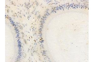 ABIN7093211 and ABIN7097222 at 1/100 staining human testicular cancer by IHC-P. (EIF4G1 anticorps)