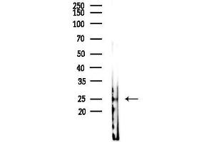 anti-Triggering Receptor Expressed On Myeloid Cells 2 (TREM2) (C-Term) antibody