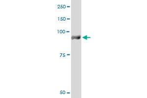 PYGM monoclonal antibody (M10), clone 2C4.